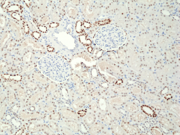 Anti-PAX8 (human), Rabbit Monoclonal (RM436)