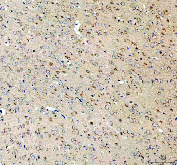 Anti-SEZ6L2 / Seizure 6-like protein 2