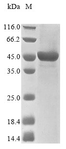 Probable E3 ubiquitin-protein ligase HERC1 (HERC1), partial, human, recombinant