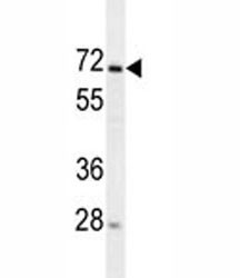 Anti-MIPEP / Mitochondrial intermediate peptidase, clone 166CT22.3.7