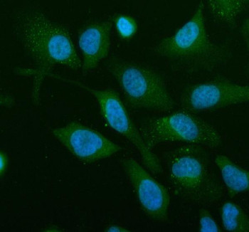 Anti-Renin receptor / ATP6AP2