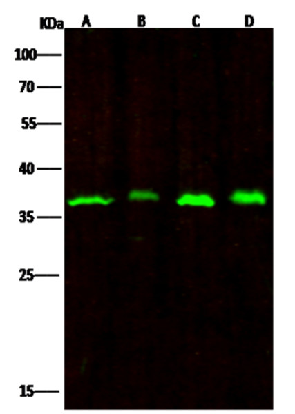 Anti-RPRD1B Monoclonal Antibody