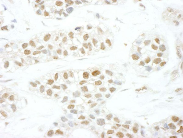 Anti-TFIIS (IHC)