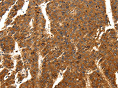 Anti-SCN11A