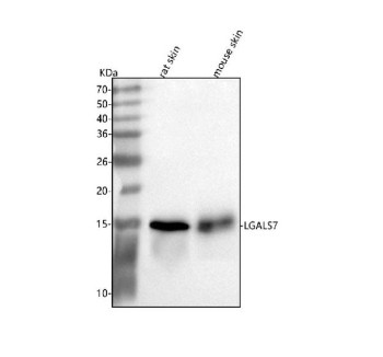 Anti-LGALS7/7B / Galectin 7