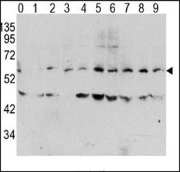 Anti-Phospho c-Myc (pT58)