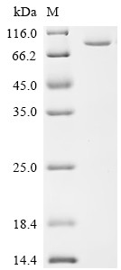 Poly [ADP-ribose] polymerase tankyrase-2 (TNKS2), partial, human, recombinant