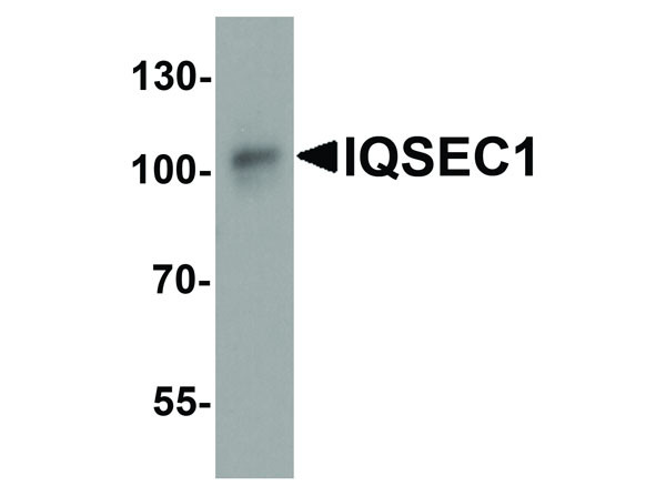 Anti-IQSEC1