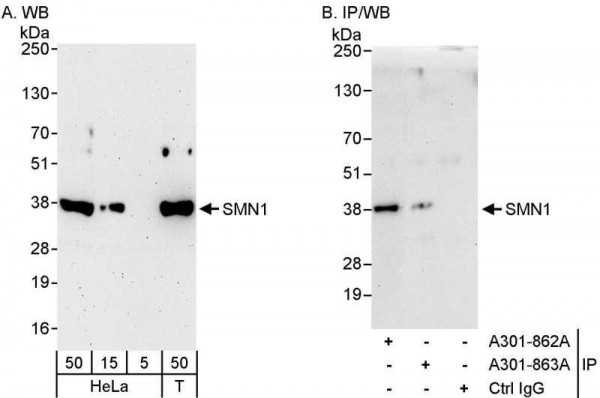 Anti-SMN1