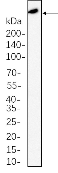 Anti-Recombinant ATM, clone 3P12