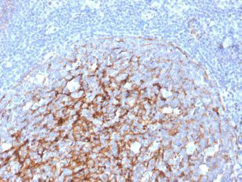 Anti-CD21 (Mature B-Cell &amp; Follicular Dendritic Cell Marker) Monoclonal Antibody (Clone: CR2/3247)