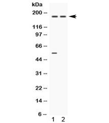 Anti-Ceruloplasmin / CP