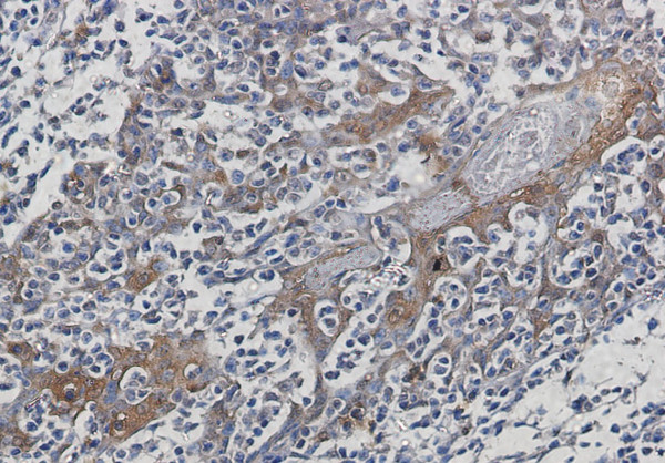 Anti-Hsp 70