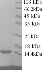 RING-box protein 2 (RNF7), human, recombinant