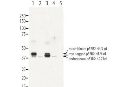Anti-RRM2B/p53R2 (Ribonucleoside-diphosphate reductase subunit M2 B)