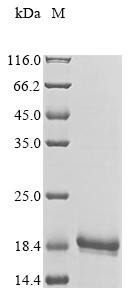 V-set and transmembrane domain-containing protein 5 (VSTM5), partial, human, recombinant