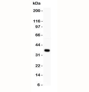 Anti-Wnt4