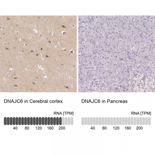 Anti-DNAJC6