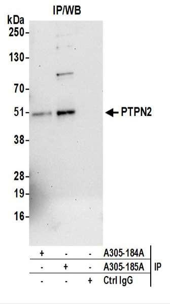 Anti-PTPN2/TCPTP