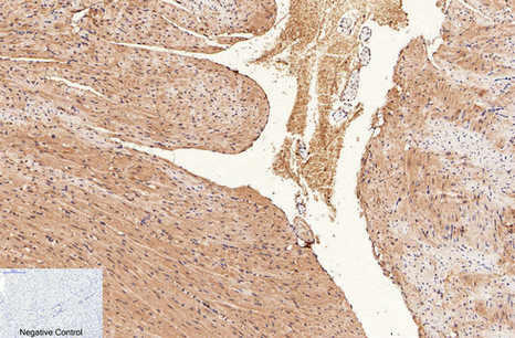 Anti-CD1A