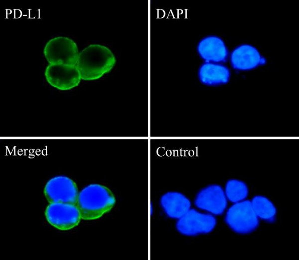 Anti-CD274 / PD-L1, clone SQab1716