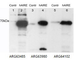 Anti-AIRE (isoforms 1 + 2), Internal