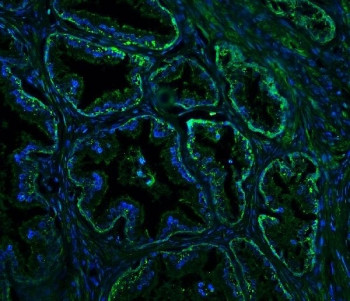 Anti-RTN4 / Reticulon 4 / Nogo A