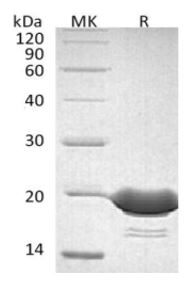 4-1BBL/TNFSF9, His, Human