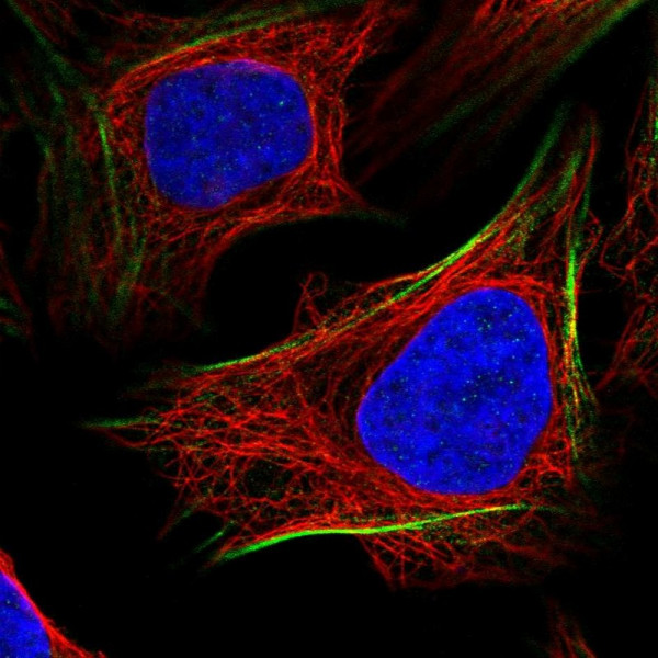 Anti-PGM1