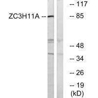 Anti-ZC3H11A