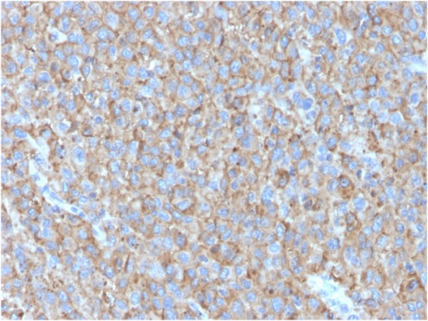 Anti-CD63 (Late Endosomes Marker), clone LAMP3/2790
