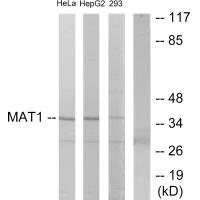 Anti-MNAT1