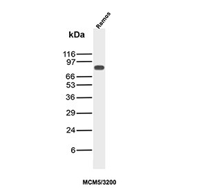 Anti-MCM5 / Minichromosome maintenance complex component 5, clone MCM5/3200