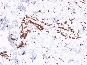 Anti-Collagen VII antibody / COL7A1, clone LH7.2