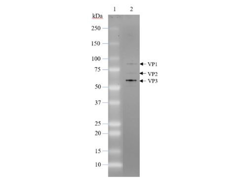 AAV2 Luciferase-eGFP