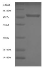 Ubiquitin carboxyl-terminal hydrolase isozyme L5 (UCHL5), human, recombinant