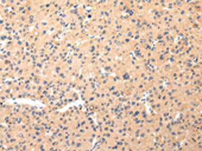 Anti-COL8A2