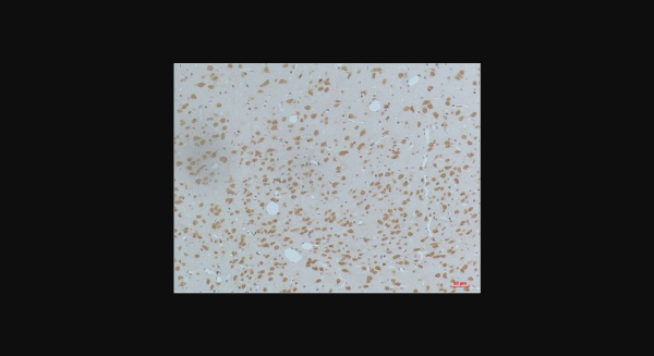 Anti-phospho-CaMKIIbeta/gamma/delta (Thr287), monoclonal