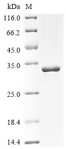 tRNA (adenine (58)-N (1))-methyltransferase catalytic subunit TRMT61A (TRMT61A), human, recombinant