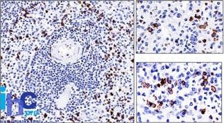 Anti-CD57 / B3GAT1 (Natural Killer Cell Marker)(Clone: NK-1)