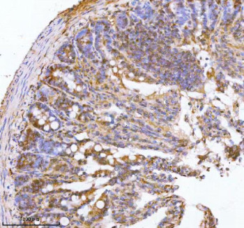 Anti-PAFAH1B2 / Platelet-activating factor acetylhydrolase IB subunit beta