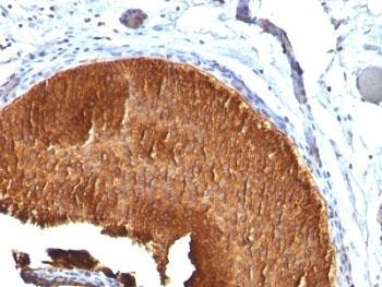 Anti-Cytokeratin 19 (CK19, KRT19), clone KRT19/799