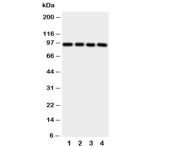 Anti-Aryl hydrocarbon Receptor (AHR)