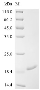 YTH domain-containing family protein 1 (YTHDF1), partial, human, recombinant