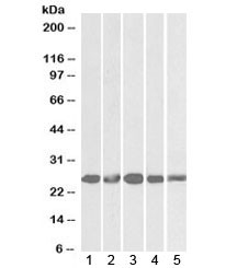 Anti-Casein kinase 2 beta