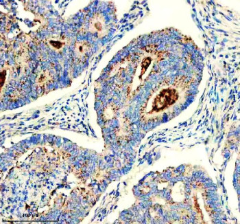 Anti-CHMP2B / Charged multivesicular body protein 2b, clone 25C36