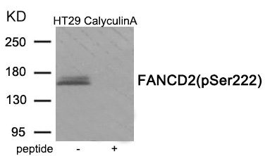 Anti-Phospho-FANCD2 (Ser222)