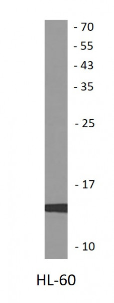 Anti-Apolipoprotein CII