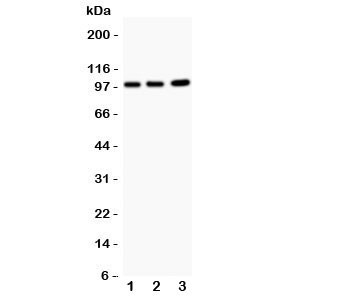 Anti-EPB41L1