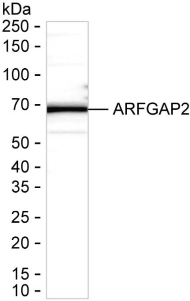 Anti-ARFGAP2